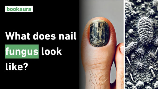 What does nail fungus look like?